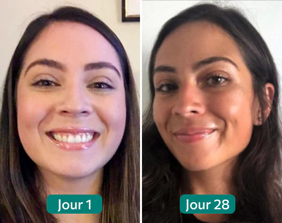 Résultat Nuclever Laura — Avant Jour 1 / Après Jour 28